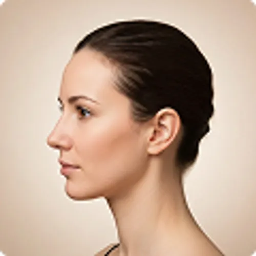 Foto antes de la rinoplastia de María Gonzáles